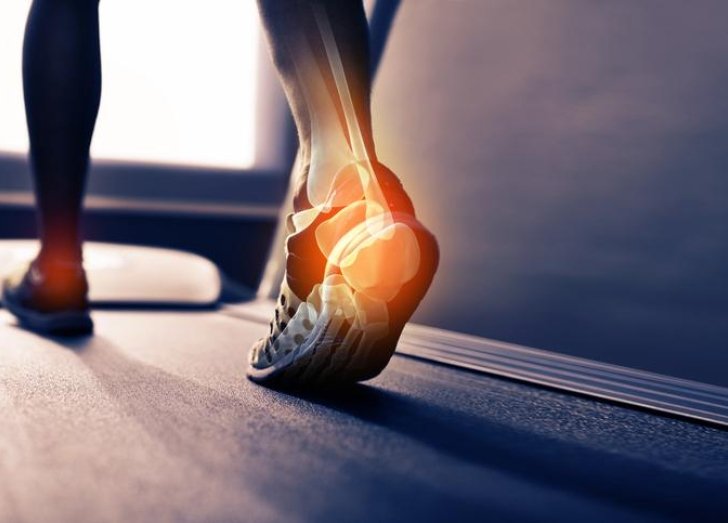 Person walking on a treadmill. 