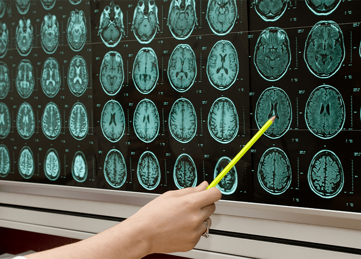Examining brain scans.