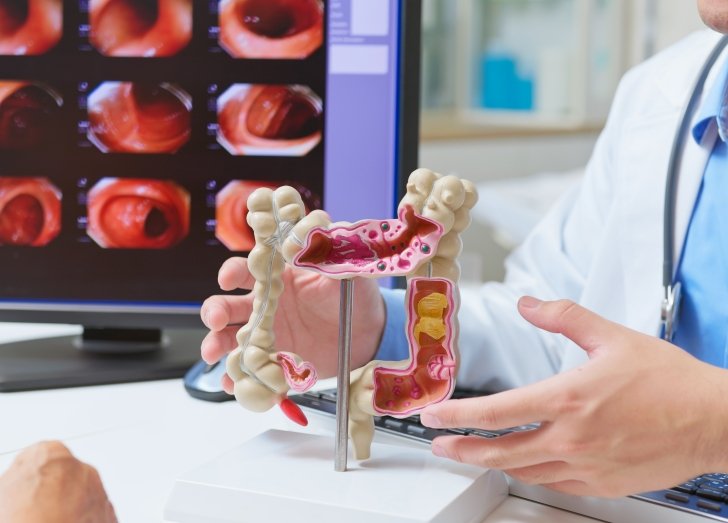 closeup asian male doctor using large intestine model with colonoscopy exam.