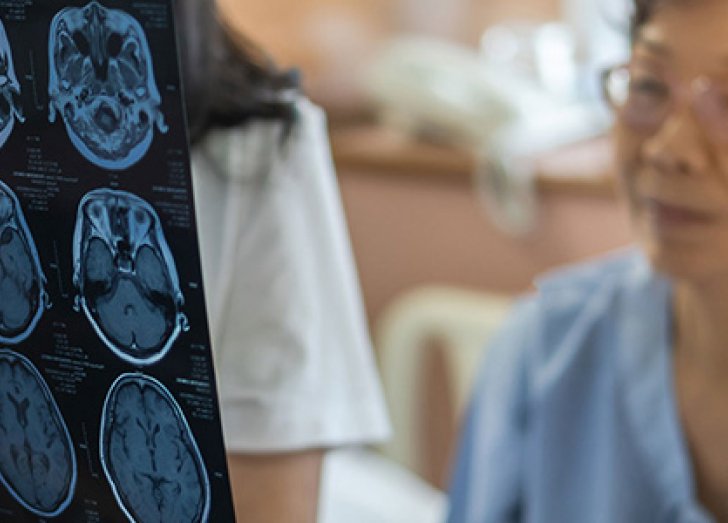 doctor showing patient x rays of their brain.