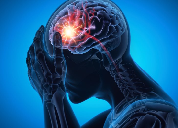 Man with a strong headache - Brain Stroke - Medical X Ray 3D Illustration with blue background