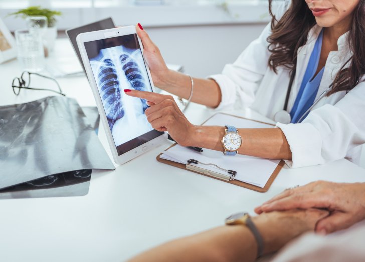 Doctor shows results to old patient x-ray of the lungs, smoking cigarettes problem. Doctor explaining lungs x-ray on Tablet PC screen to young patient. Doctor showing female patient x-ray shot in clinic office. Coronavirus chest X-ray.