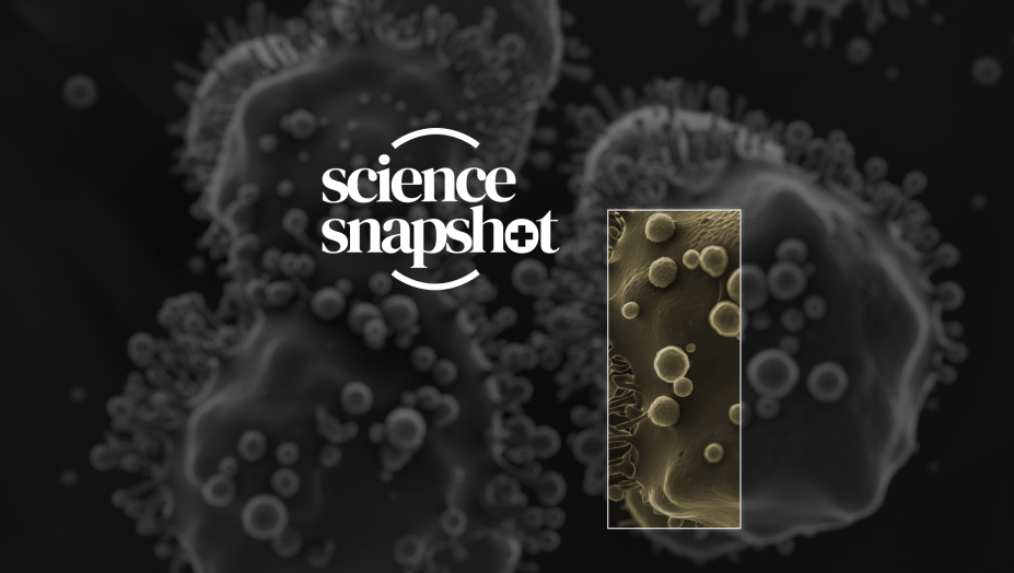 Science snapshot pancreatic 